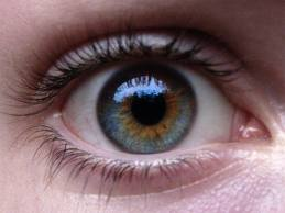 kolor oczu - heterochromia